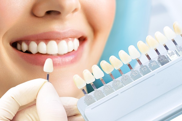 Can Dental Veneers Fix Chipped, Stained, Or Uneven Teeth?