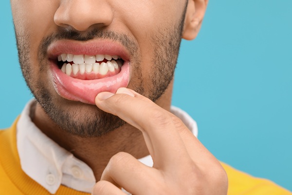 Gum Disease Treatment: Stages, Best Therapies, And How To Prevent Its Return